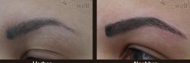 Microblading